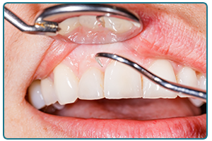 periodontics pasadena